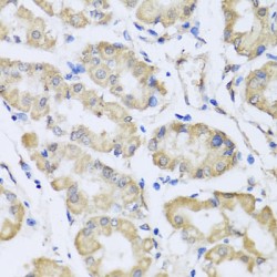 Reticulocalbin 2 (RCN2) Antibody