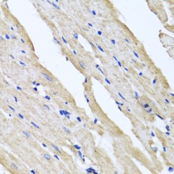 Reticulocalbin 2 (RCN2) Antibody