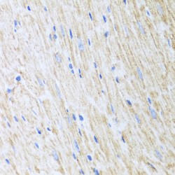 Reticulocalbin 2 (RCN2) Antibody