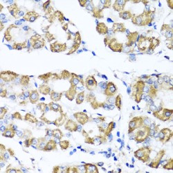 Serine Hydroxymethyltransferase, Cytosolic (SHMT1) Antibody