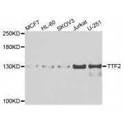 Western blot analysis of extracts of various cell lines, using TTF2 antibody (abx006525) at 1/1000 dilution.