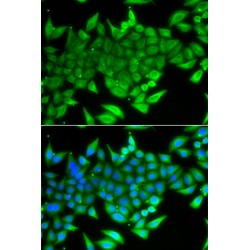 Transcription Termination Factor 2 (TTF2) Antibody