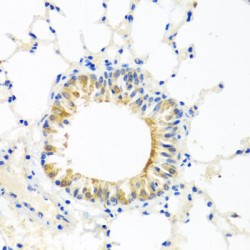 Coenzyme Q7, Hydroxylase (COQ7) Antibody