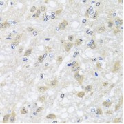 Immunohistochemistry of paraffin-embedded rat brain using HARS2 antibody (abx006533) at dilution of 1/100 (40x lens).