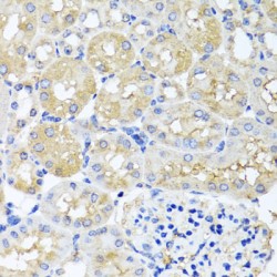 Probable Histidine-tRNA Ligase, Mitochondrial (HARS2) Antibody