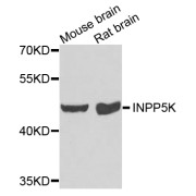 Western blot analysis of extracts of various cell lines, using INPP5K antibody (abx006540) at 1/1000 dilution.