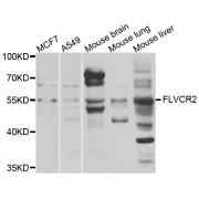 Western blot analysis of extracts of various cell lines, using FLVCR2 antibody (abx006544) at 1/1000 dilution.