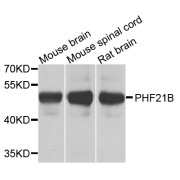 Western blot analysis of extracts of various cell lines, using PHF21B antibody (abx006556) at 1/1000 dilution.