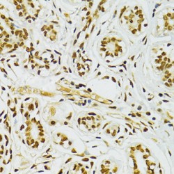 Double-Stranded RNA-Specific Adenosine Deaminase (ADAR) Antibody