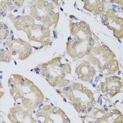 Bisphosphoglycerate Mutase (BPGM) Antibody