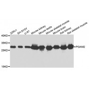 Western blot analysis of extracts of various cell lines, using PGAM2 antibody (abx006577) at 1/1000 dilution.