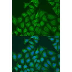 Procollagen Lysine-1,2-Oxoglutarate-5-Dioxygenase 1 (PLOD1) Antibody