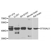 Western blot analysis of extracts of various cell lines, using ST3GAL5 antibody (abx006586) at 1/1000 dilution.