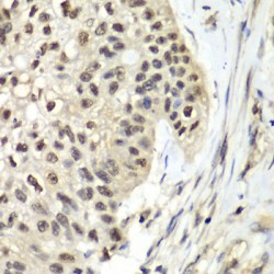 Replication Factor C Subunit 5 (RFC5) Antibody