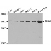 Western blot analysis of extracts of various cell lines, using TRIB3 antibody (abx006614) at 1/1000 dilution.