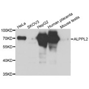 Western blot analysis of extracts of various cell lines, using ALPPL2 antibody (abx006628) at 1/1000 dilution.