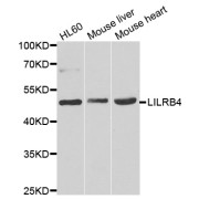 Western blot analysis of extracts of various cell lines, using LILRB4 antibody (abx006638) at 1/1000 dilution.