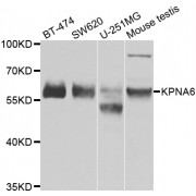 Western blot analysis of extracts of various cell lines, using KPNA6 antibody (abx006643) at 1/1000 dilution.