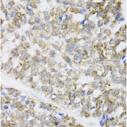 Mitogen-Activated Protein Kinase Kinase Kinase MLT (ZAK) Antibody