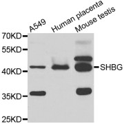 Western blot analysis of extracts of various cell lines, using SHBG antibody (abx006654) at 1/1000 dilution.