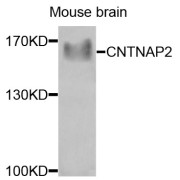 Western blot analysis of extracts of mouse brain, using CNTNAP2 antibody (abx006658) at 1/1000 dilution.