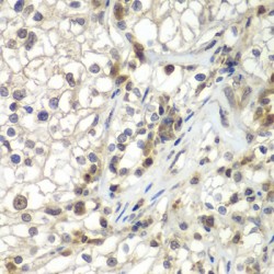 Tether Containing UBX Domain for GLUT4 / TUG (ASPSCR1) Antibody