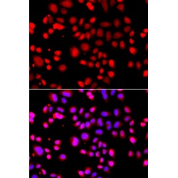 Tether Containing UBX Domain for GLUT4 / TUG (ASPSCR1) Antibody