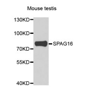 Western blot analysis of extracts of mouse testis, using SPAG16 antibody (abx006661) at 1/1000 dilution.