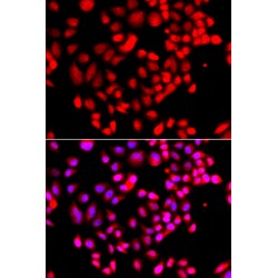 Ribosomal Protein S6 Kinase Like 1 (RPS6KL1) Antibody