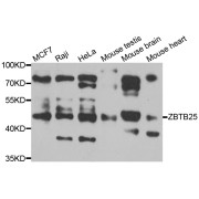 Western blot analysis of extracts of various cell lines, using ZBTB25 antibody (abx006665) at 1/1000 dilution.