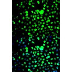 Zinc Finger And BTB Domain-Containing Protein 25 (ZBTB25) Antibody