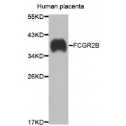 Western blot analysis of extracts of human placenta, using FCGR2B antibody (abx006667) at 1/1000 dilution.