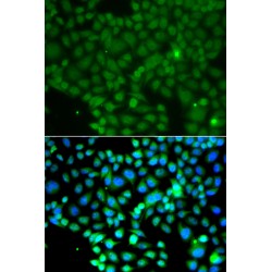 Fyn Related Kinase (FRK) Antibody