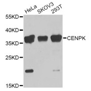 Western blot analysis of extracts of various cell lines, using CENPK Antibody (abx006672) at 1/1000 dilution.