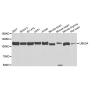 Western blot analysis of extracts of various cell lines, using UBE3A antibody (abx006695) at 1/1000 dilution.