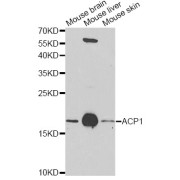 Western blot analysis of extracts of various cell lines, using ACP1 antibody (abx006698) at 1/1000 dilution.