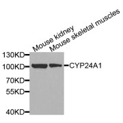 Western blot analysis of extracts of various cell lines, using CYP24A1 antibody (abx006699) at 1/1000 dilution.