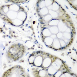 Cell Division Cycle Protein 27 (CDC27) Antibody