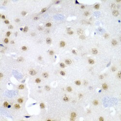 Cell Division Cycle Protein 27 (CDC27) Antibody