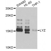 Western blot analysis of extracts of various cell lines, using LYZ Antibody (abx006720) at 1/1000 dilution.