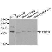 Western blot analysis of extracts of various cell lines, using PPP1R1B antibody (abx006723) at 1/1000 dilution.