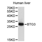 Western blot analysis of extracts of human liver, using BTG3 antibody (abx006733).