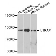 Western blot analysis of extracts of various cell lines, using IL1RAP antibody (abx006770) at 1/1000 dilution.