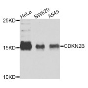 Western blot analysis of extracts of various cell lines, using CDKN2B antibody (abx006792) at 1/1000 dilution.