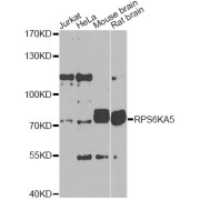 Western blot analysis of extracts of various cell lines, using RPS6KA5 Antibody (abx006794) at 1/1000 dilution.