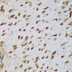 Nucleolin (NCL) Antibody