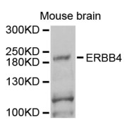 Western blot analysis of extracts of mouse brain, using ERBB4 antibody (abx006809) at 1/1000 dilution.