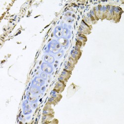 Receptor Tyrosine-Protein Kinase ErbB-4 (ERBB4) Antibody