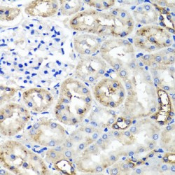 Tumor Necrosis Factor-Inducible Gene 6 Protein (TNFAIP6) Antibody