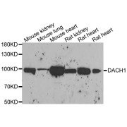 Western blot analysis of extracts of various cell lines, using DACH1 antibody (abx006849) at 1/1000 dilution.